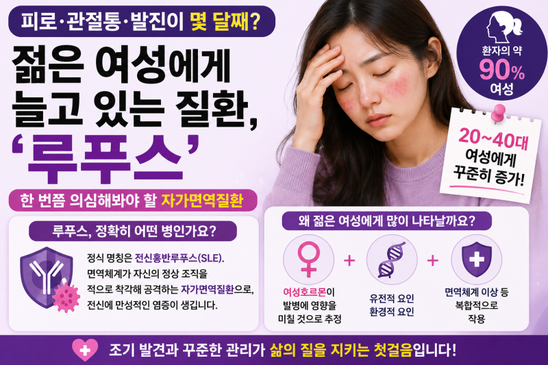 피곤한 게 아니라 루푸스일지도? — 20~40대 여성이라면 꼭 알아둘 질환