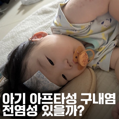 아기 아프타성 구내염 전염될까? 바이러스성 구내염 차이