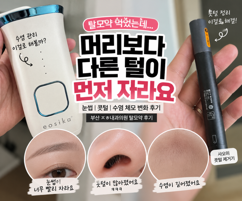 부산 ㅈㅎ내과의원 탈모약 끊었다가 다시 먹기 시작했어요여성 탈모약 눈썹 콧털 수염 변화