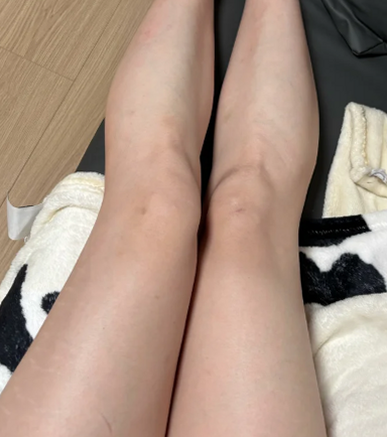 무릎치료기 집에서 통증 완화와 물리치료 돕는 기기 팁