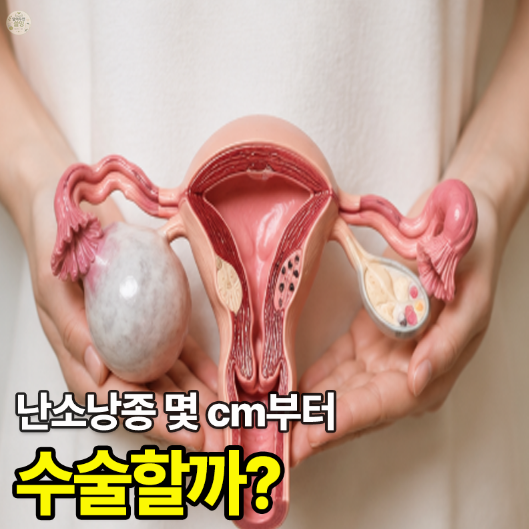 난소낭종수술 꼭 해야 할까? 수술 기준·복강경·회복기간 “크기만 보고 결정하면 안 되는 ....