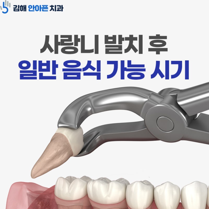 사랑니 발치 후 일반적인 음식은 언제부터 될까요?