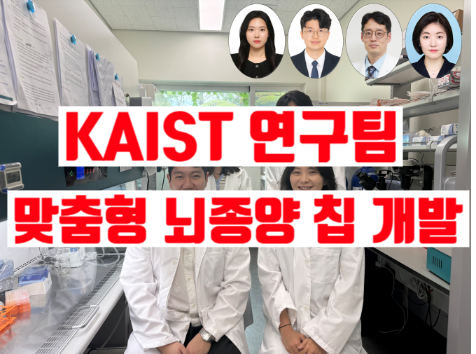 환자 뇌종양 세포로 ‘칩’ 만들어 치료제 효과 먼저 확인…교모세포종 맞춤치료 새 길