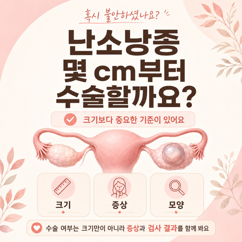 난소낭종 수술해야 할까요 크기 증상 치료까지 핵심정리