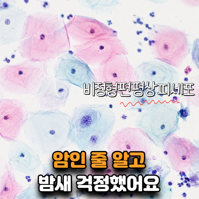 “암인 줄 알고 밤새 검색했어요” 비정형편평상피세포, 다음엔 뭘 해야 할까?