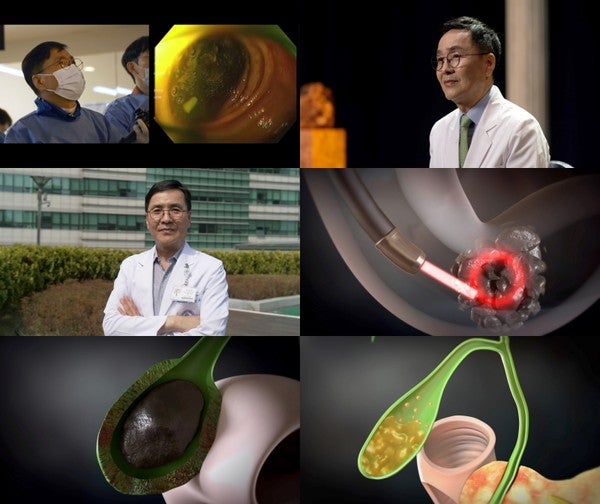 천영국교수 프로필 EBS 명의 소화기내과 의사 담석증 증상 원인 치료