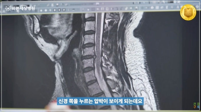 오른쪽 날개뼈 통증 날개뼈 사이가 묵직하게 땡기는 원인과 치료법