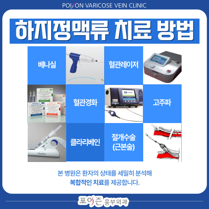 하지정맥류수술비용, 건강보험·실비보험 적용 기준과 급여·비급여 총정리