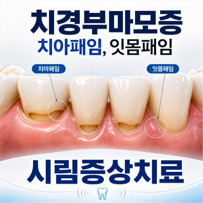 동대문 치경부마모증 시린이 치료 (증상,예방법 정리)