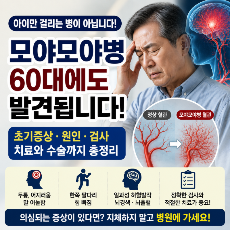 모야모야병은 아이만 걸릴까?｜60대에도 발견되는 모야모야병 초기증상·검사·치료