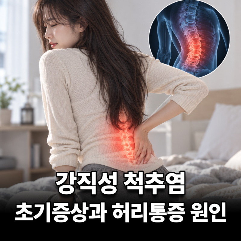강직성 척추염 초기증상과 허리통증 원인 및 폐활량 관리법