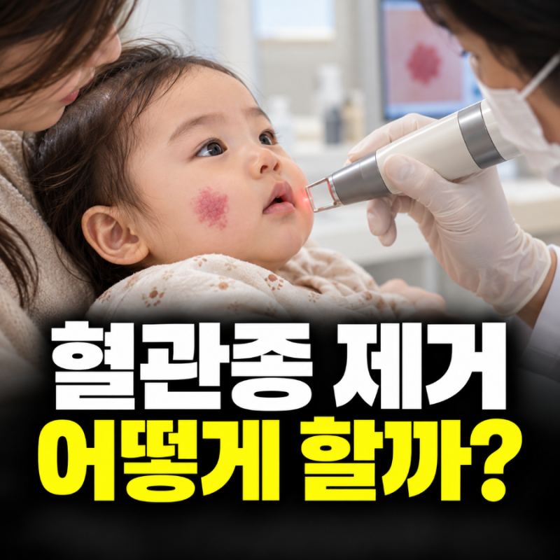혈관종 제거 어떻게 할까? 레이저부터 약물치료까지