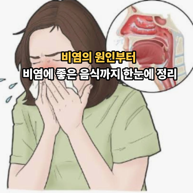 비염에 좋은 음식 TOP6