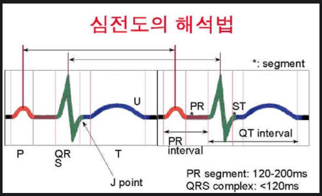 [CV] 12-Lead EKG 읽는 법 6단계 & STEMI(ST절 상승 심근경색) DAR 차팅 완벽 정리