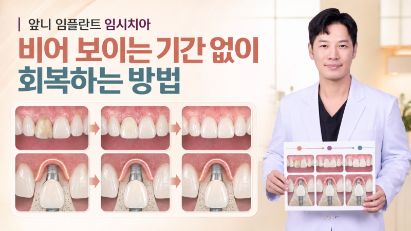 이대 치과 앞니 임플란트 임시치아, 발치 즉시 임플란트와 당일 임시치아로 회복한 사례