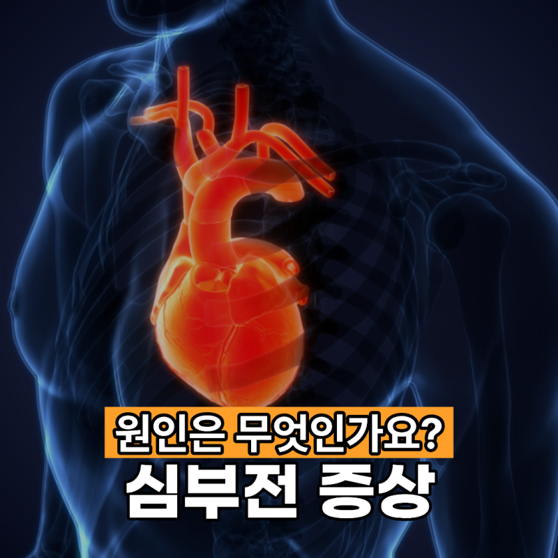 심부전 증상 원인은 무엇이 있을까요?