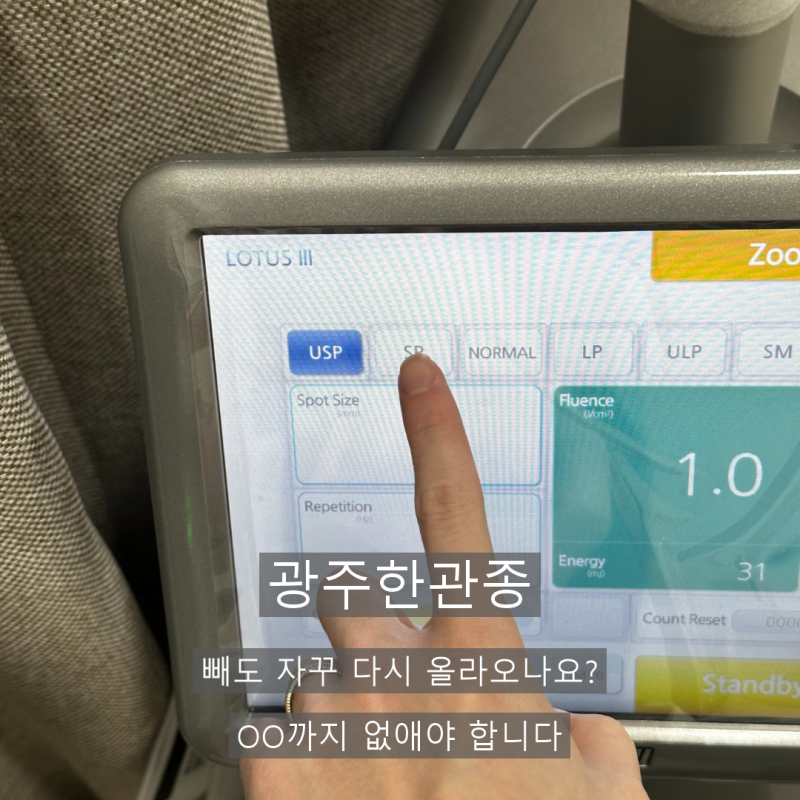 광주한관종 빼도 자꾸 다시 올라오나요? OO까지 없애야 합니다