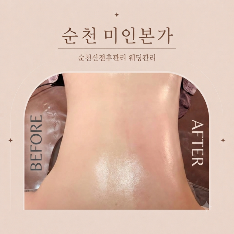 순천에스테틱｜미인본가순천점 순천산후체형관리 웨딩관리 순천산후마사지 순천산후관리