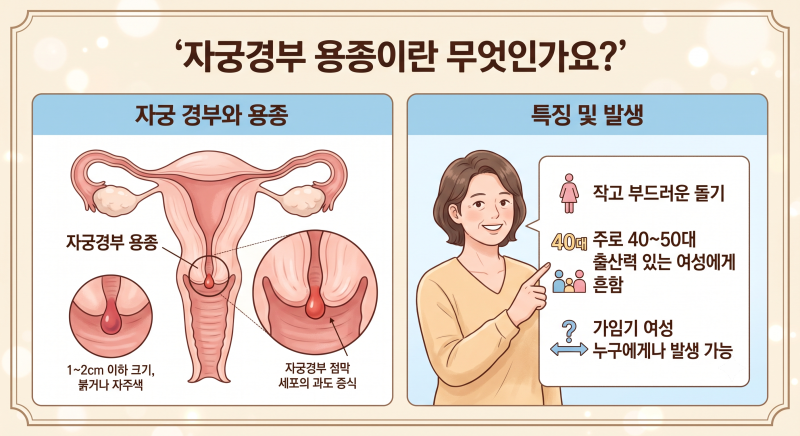 자궁경부에 혹이 생겼는데, 용종(폴립) 그냥 둬도 되나요?