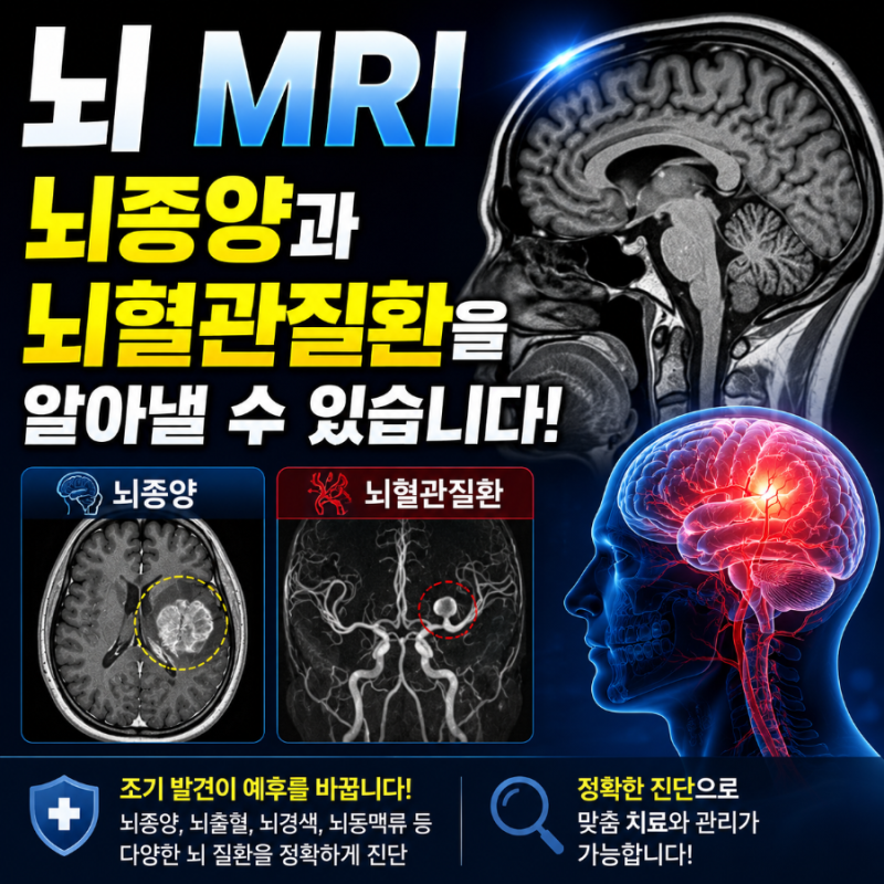 뇌 MRI 검사로 알 수 있는 것! 뇌종양부터 뇌혈관질환까지 총정리