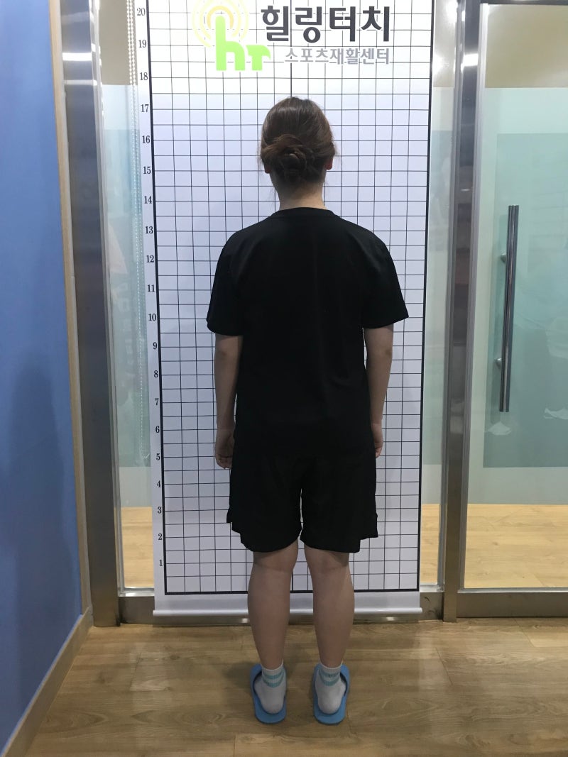 라운드숄더 숨 답답함 해결, 어깨교정으로 호흡을 편안하게
