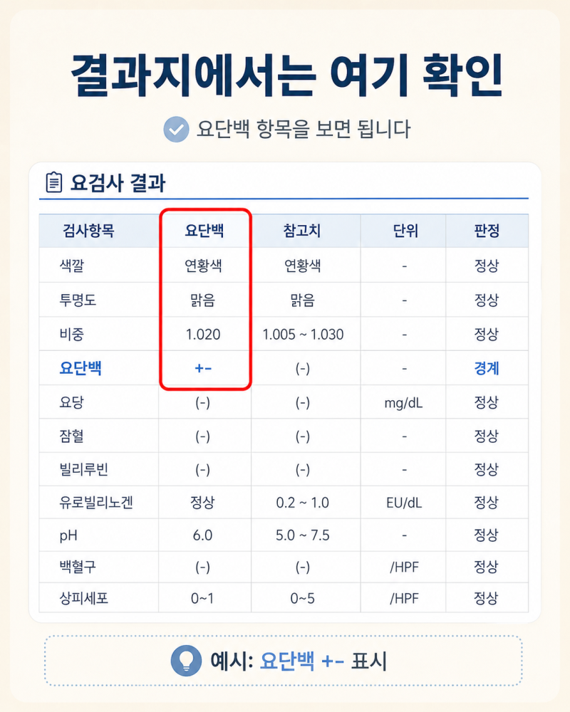 건강검진 단백뇨 양성, 어떤 검사를 추가로 해야 할까?