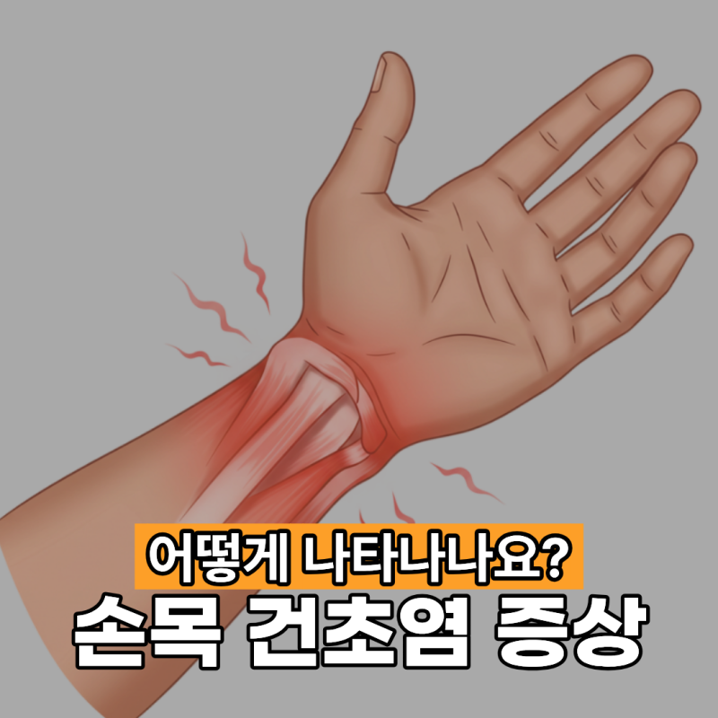 손목 건초염 증상 어떻게 나타나나요?
