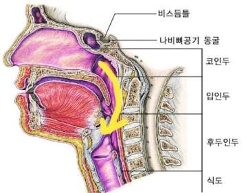 인후염과 편도염 - 증상과 원인 - 치료방법