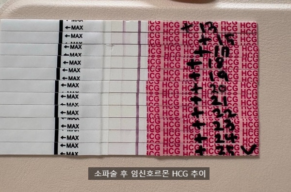 계류유산 소파술 후 생리, 배란까지 얼마나 걸렸을까 (계류유산 회복, 재임신 기록)