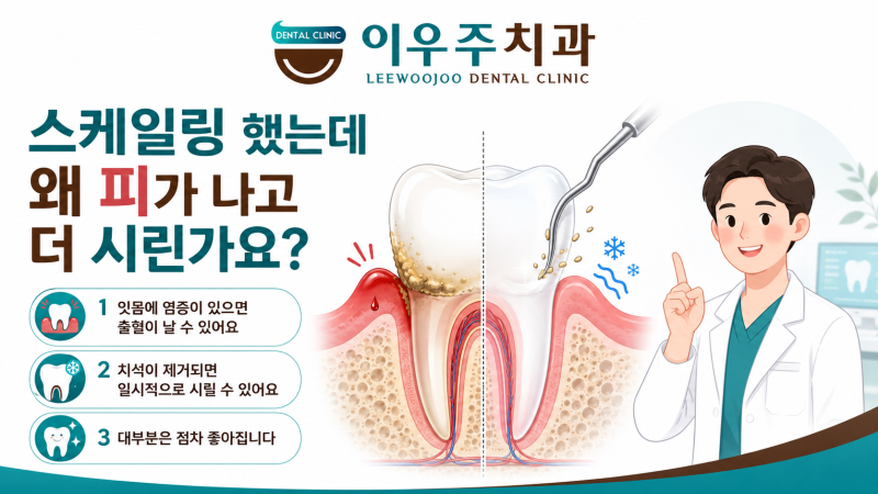 스케일링 했는데 왜 피가 나고 더 시린가요?