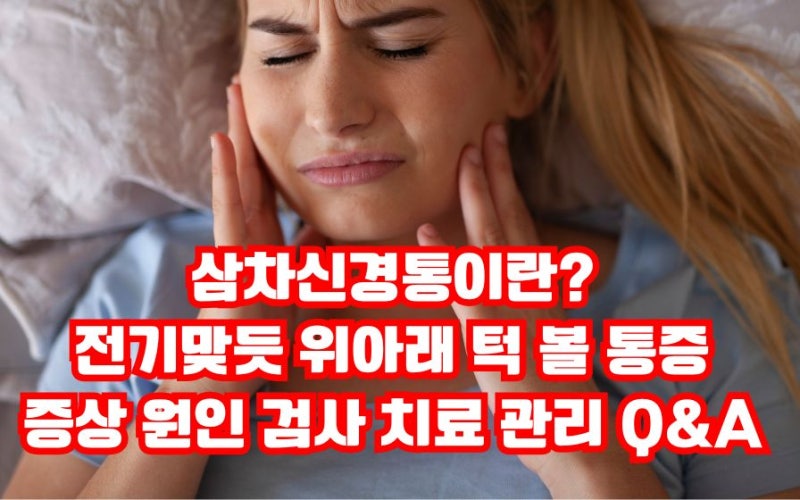삼차신경통이란? 전기맞듯 위아래 턱 볼 통증 증상 원인 검사 치료 관리 Q&A