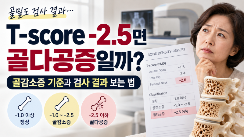 골밀도 T-score -2.5면 골다공증일까?골감소증 기준과 골밀도 검사 결과 보는 법 (EP032)