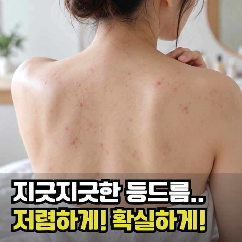 강남피부과 등드름흉터 치료끊고 몽디에스 아워스킨 바디워시 바디미스트 루틴