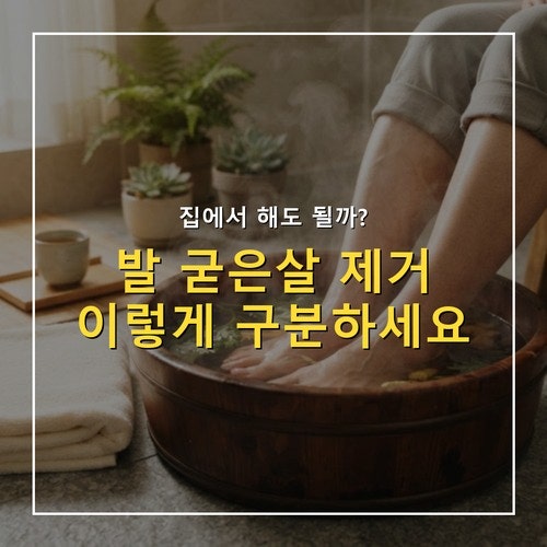 발 굳은살 제거, 집에서 해도 되는 경우와 병원 가야 하는 경우