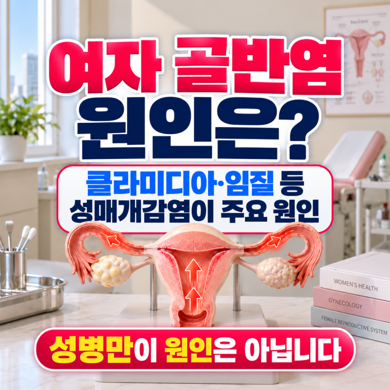 여자 골반염 증상과 원인, 성병 때문일까? 검사와 치료까지
