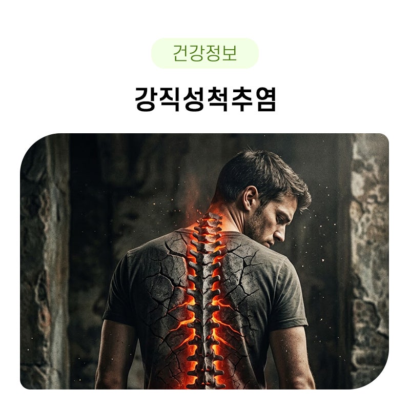 강직성 척추염 원인, 증상, 치료, 완치의 모든 것