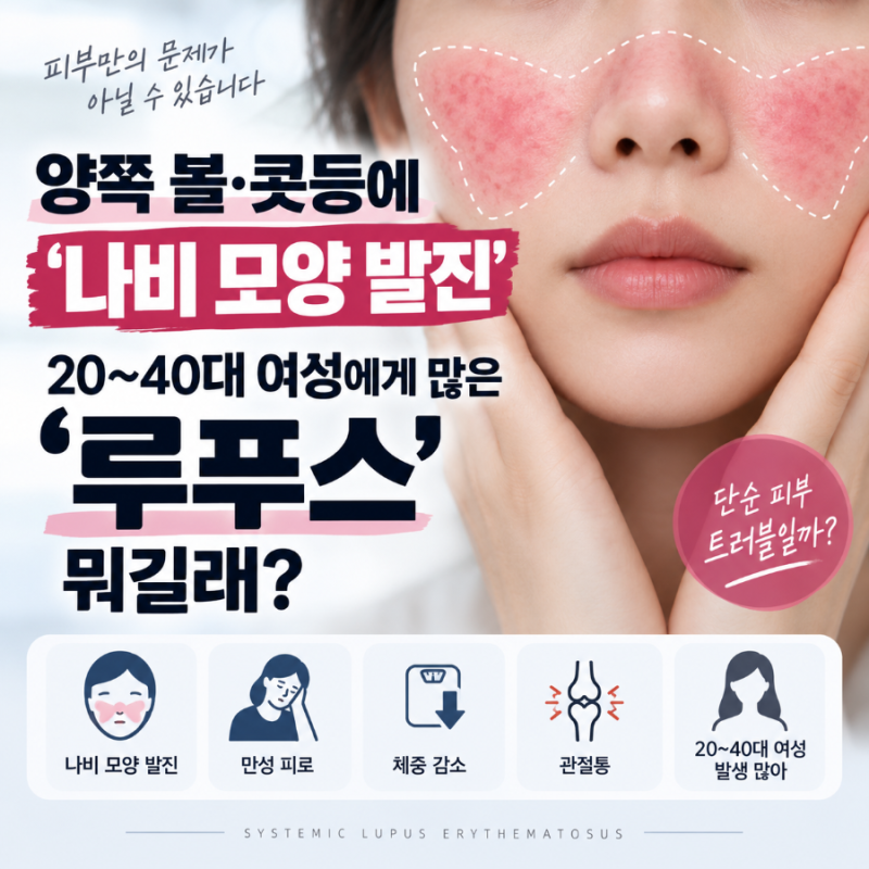 양쪽 볼·콧등에 ‘나비 모양 발진’…20~40대 여성에게 많은 ‘루푸스’ 뭐길래
