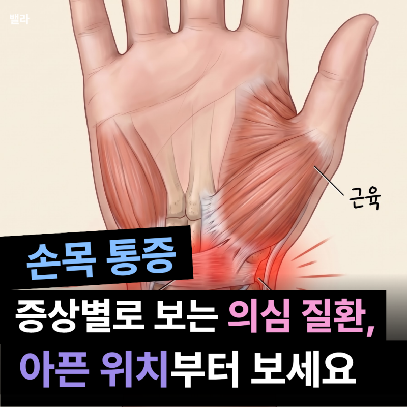 손목 아프면 다 손목터널증후군?아픈 위치마다 질환 싹 다 정리해드릴게요