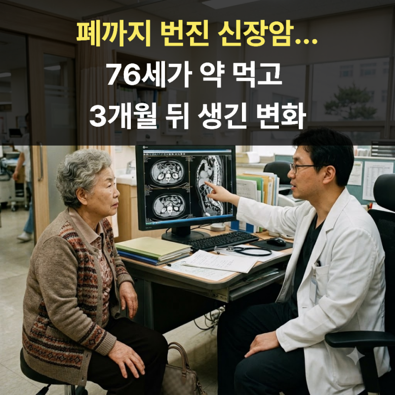 폐까지 번진 신장암...76세가 약 먹고 3개월 뒤 생긴 변화