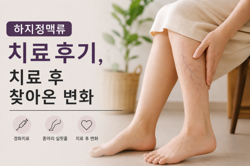 하지 정맥류 경화 치료 후기, 치료 후 찾아온 변화