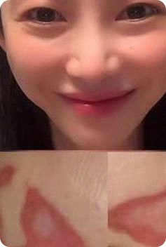 권민아 심재성 화상 2도 화상 병원 소송