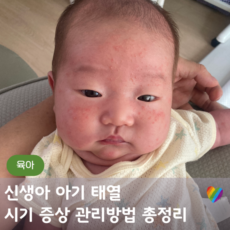 신생아 아기 태열 관리 방법 꿀팁 3가지 경험담
