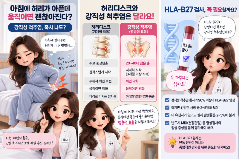 아침 허리통증이 움직이면 좋아진다면? 강직성 척추염 증상·허리디스크 차이·HLA-B27 검사