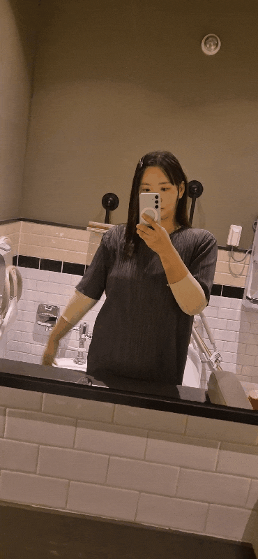 대전팔뚝지방흡입 내돈내산 일주일후기 | 2100cc 뺀사람, 솔직한 리얼후기 운전가능?!