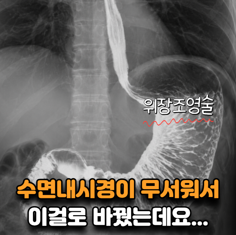 “수면내시경이 무서워서 바꿨어요” 위장조영촬영, 작은 위암도 보일까?