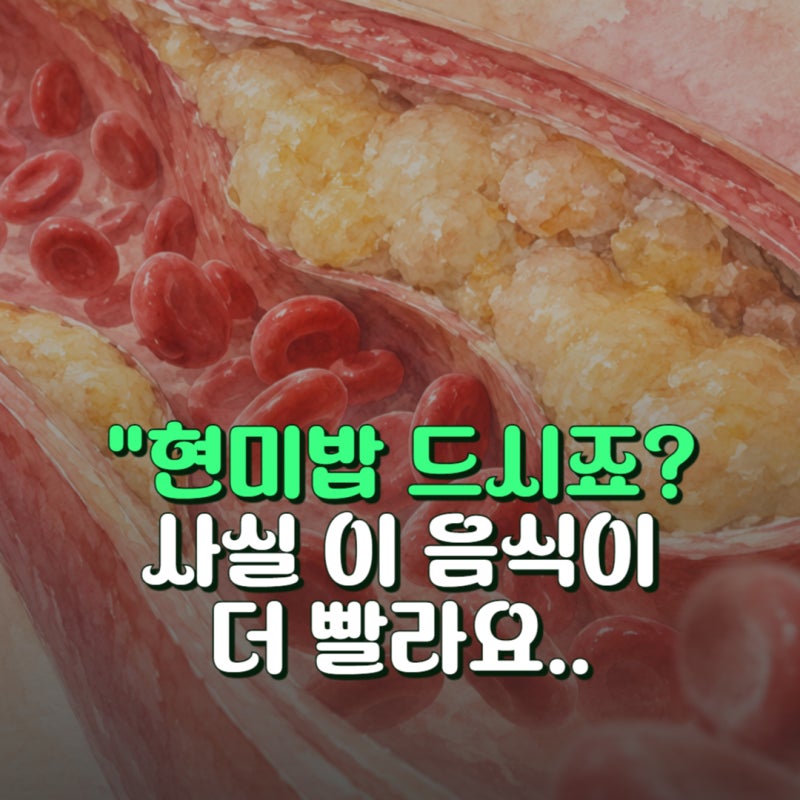 현미밥보다 효과 빠른 고지혈증에 좋은 음식 TOP 3과 식단표