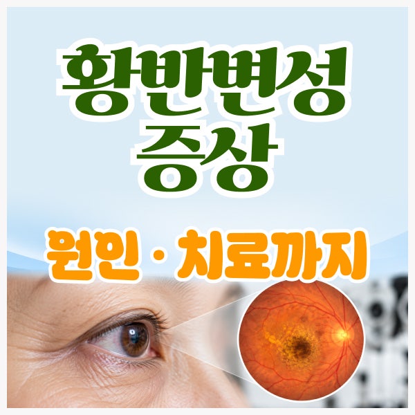 황반변성 증상·원인·치료 총정리｜시야가 흐리고 휘어 보인다면?