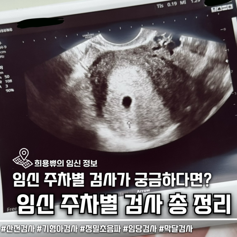 임신 주차별 검사 총정리 초기검사부터 임당검사 막달검사까지