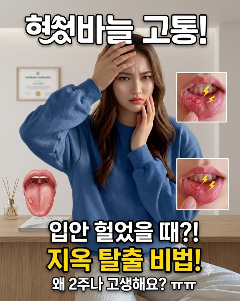 혓바늘 구내염 약 추천! 입안 헐었을 때 빠르게 낫는 법