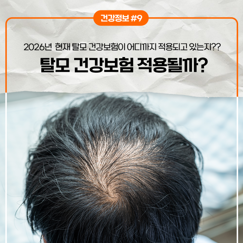 탈모 건강보험 적용될까? 2026년 현재 어디까지 왔나｜원형탈모와 유전성 탈모 차이